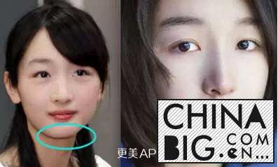周冬雨承认整容了吗？整容前后照片对比与各路女明星成功撞脸
