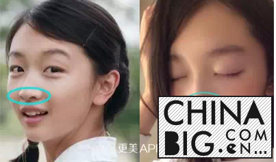 周冬雨承认整容了吗？整容前后照片对比与各路女明星成功撞脸