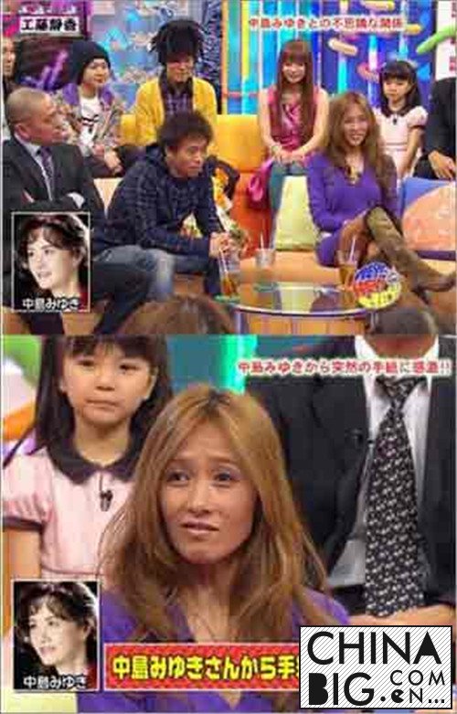 木村拓哉吻工藤静香 工藤静香整容失败惨不忍睹