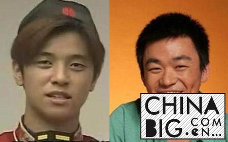 小猪整容前酷似王宝强