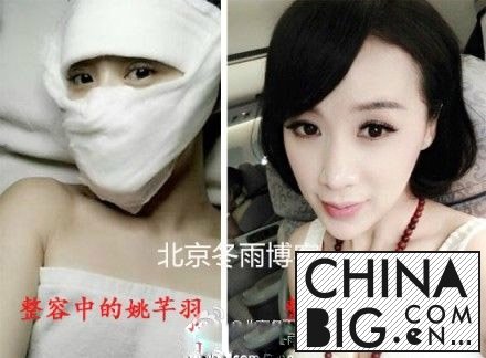 姚芊羽整容前后对比照片曝光  姚芊羽整容失败变成“蛇精病”