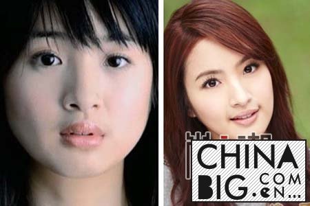 林依晨整容了吗 林依晨整容前后对比照_shangc.net