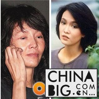 郑裕玲整容照片吓死人 郑裕玲整容前后对比照 郑裕玲资料