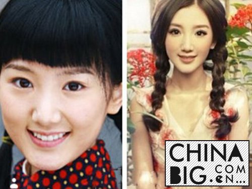 毛晓彤有没有整容呢？   毛晓彤整容前后对比照曝光