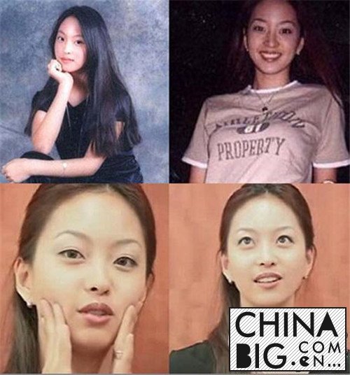 ɪ¼ʲôҺɪݱ仯ǰԱƬ
