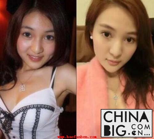 郭美美整容前后照片曝光 揭郭美美为什么坐牢