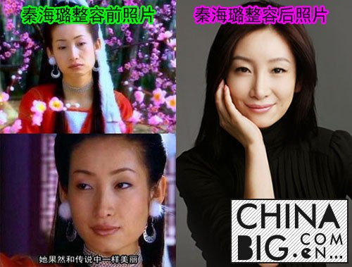 秦海璐承认整容了？   秦海璐整容前后照片