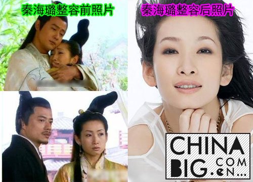 秦海璐承认整容了？   秦海璐整容前后照片
