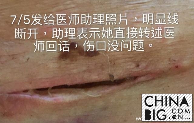 伊能静生女后与接生医生互掐升级 伊能静爆美国主刀医生私信